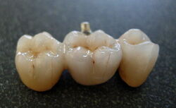 C:\Users\1\Desktop\Bridge_from_dental_porcelain.jpg